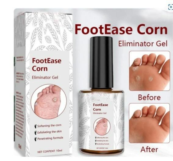 Feet Corn Removal Care Serum 30ml ( Pack of 1 )