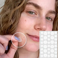 Quality Pimple Patches (72 pieces)